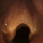 vocal chords