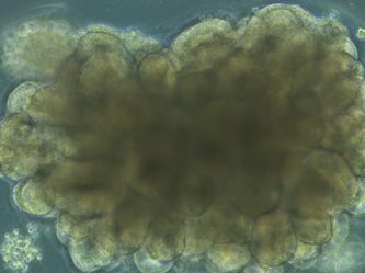 Besivystantis smegen organoidas