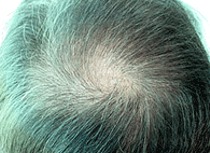 Hair vertex
